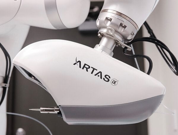 Why Artas Is The Best Hair Transplant Technique In The Usa And The World Salameh Plastic