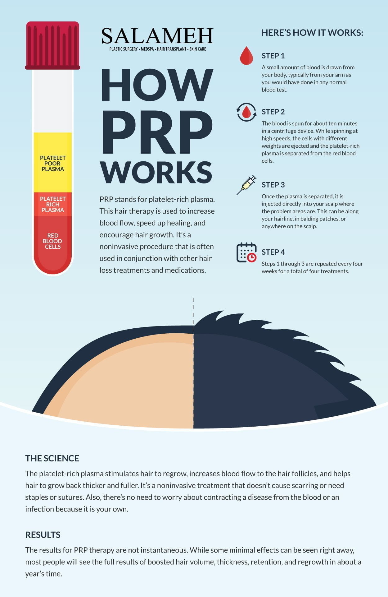 How Do Plasma Injections for Hair Work - Infographic