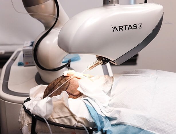 ARTAS robotics performing hair transplant surgery on a patient