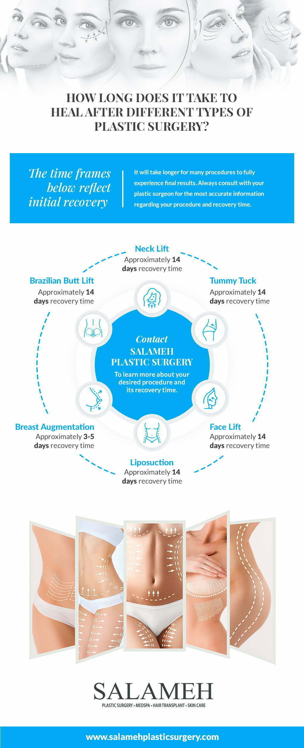 Infographic how long does it take to heal after different types of plastic surgery