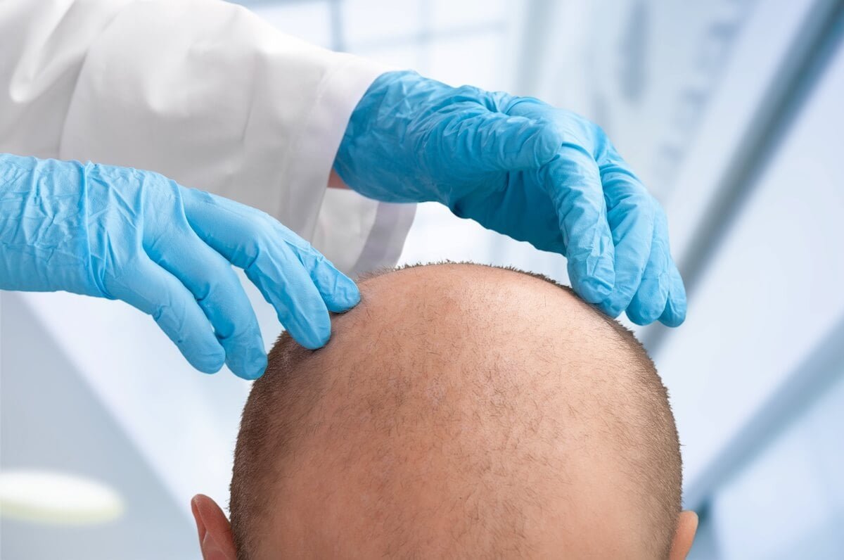 a plastic surgeon touching a man’s bare head