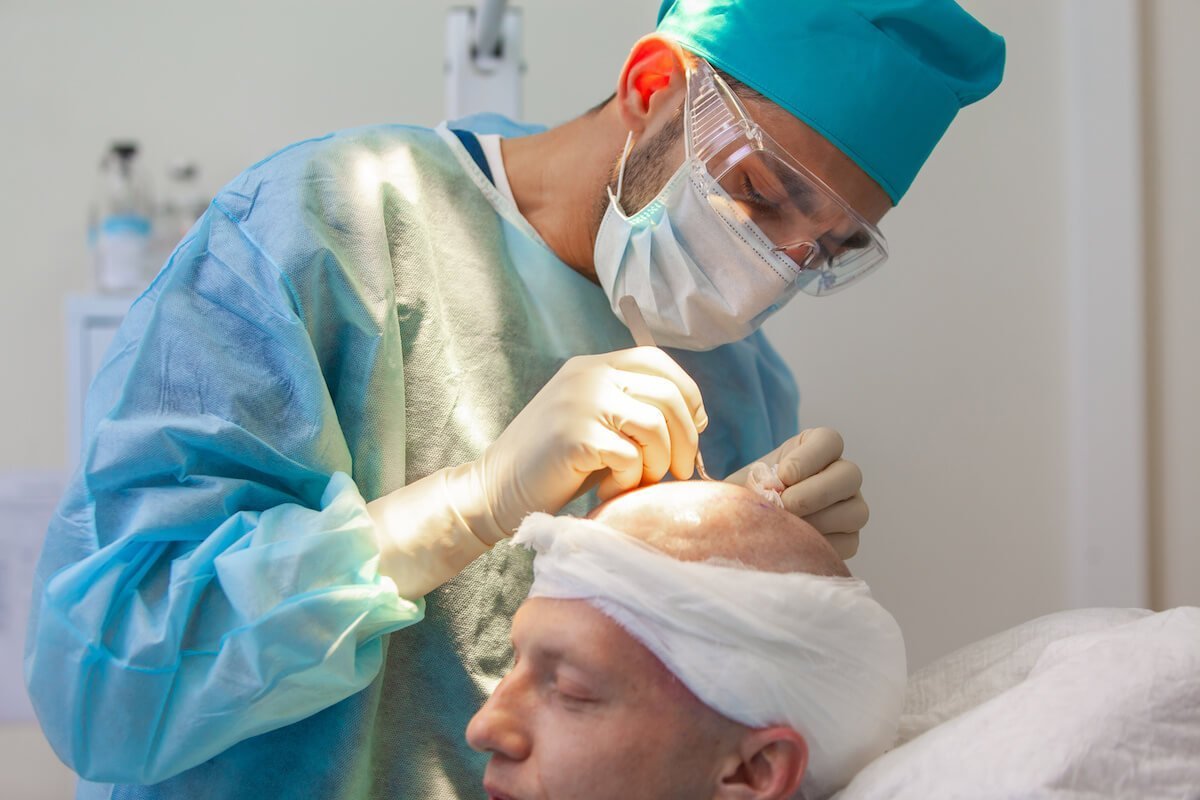 a surgeon preparing a man’s head for robotic hair transplant
