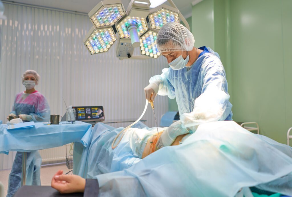 A doctor with a nurse on the side performing liposuction surgery at a patient.