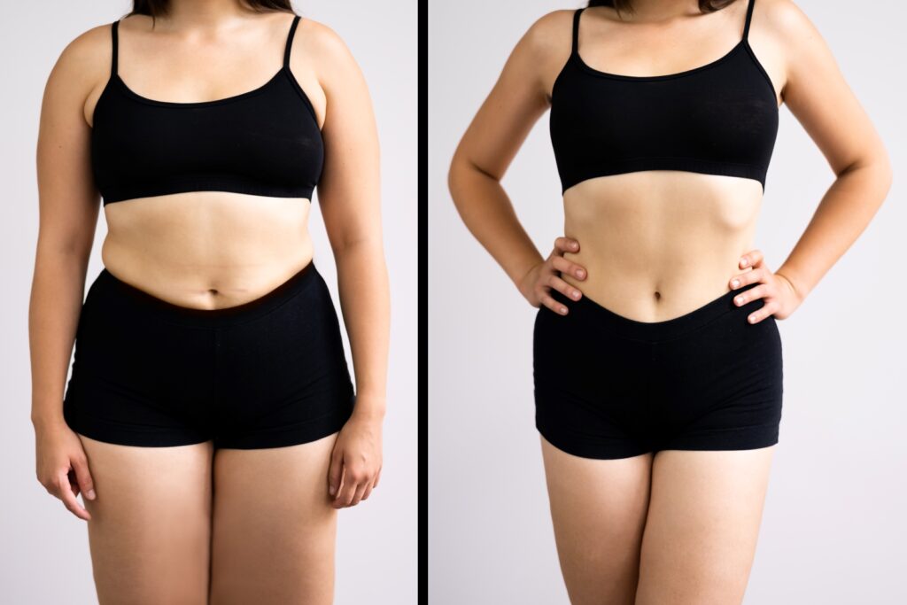 Before and after picture of a women wearing sports bra and cycling showing improvements after tummy tuck surgery