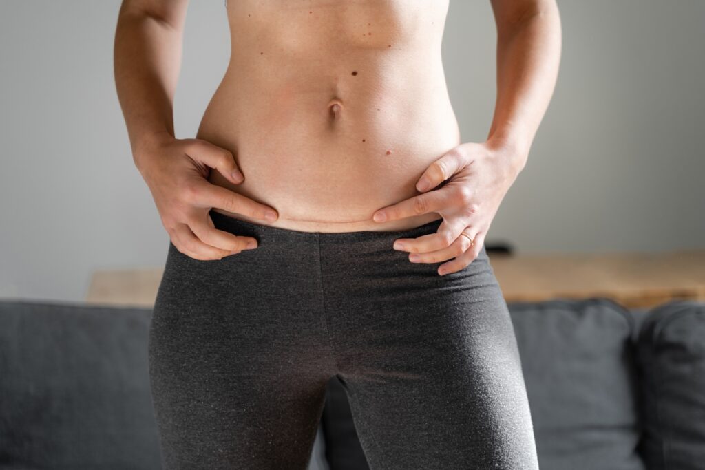 7 Tips For Tummy Tuck Recovery