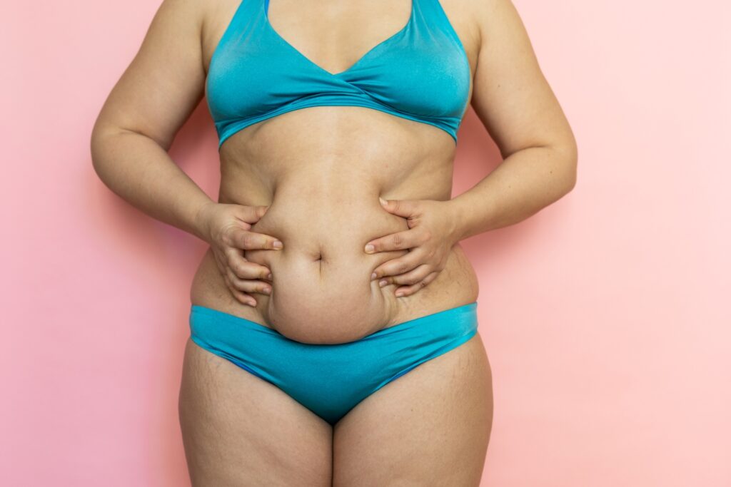 Massage woman sagging belly with hands closeup, folds on stomach, loose skin and cellulite. Naked overweight plus size girl on pink background in blue underwear. Concept of tummy tuck