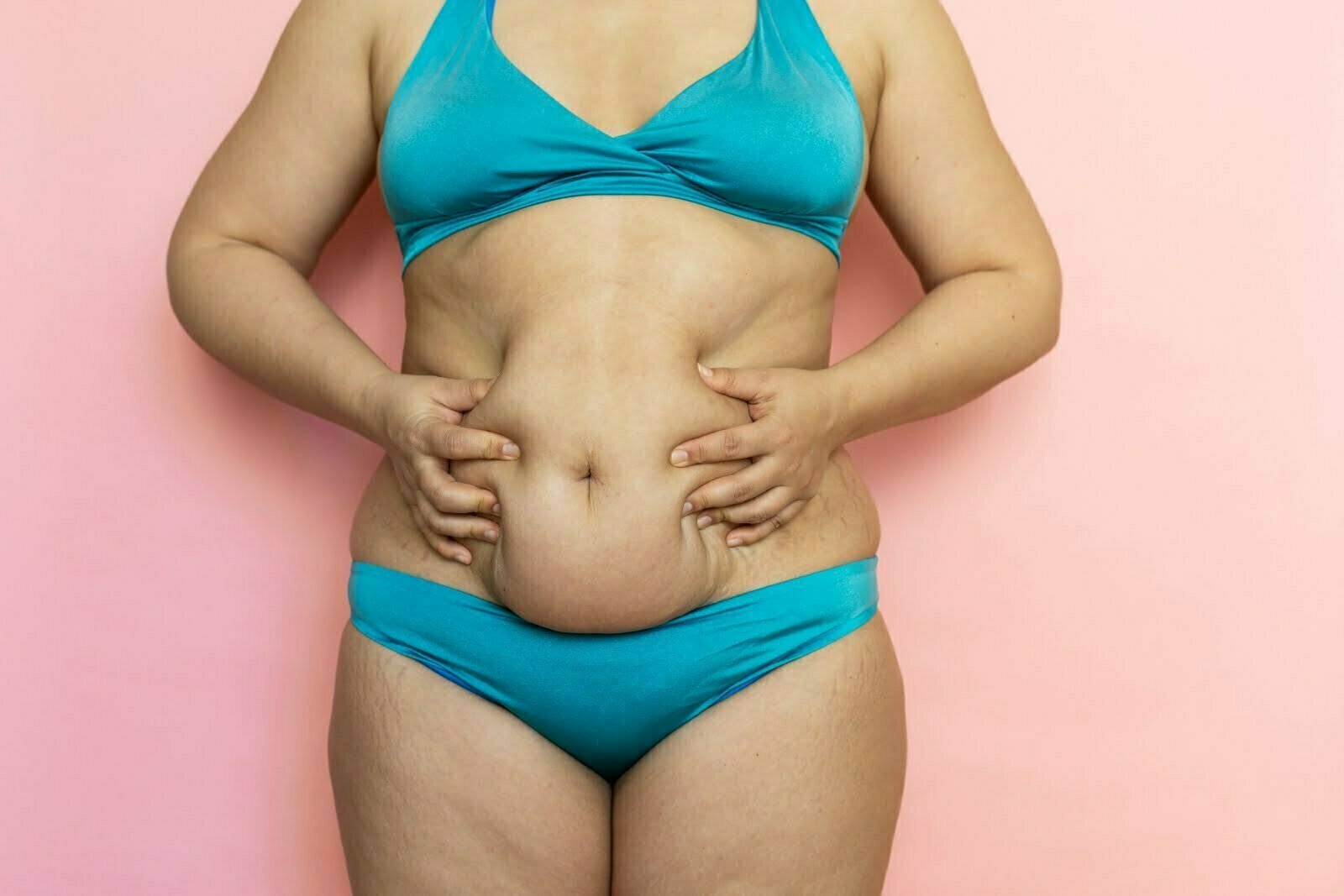 Woman belly Tummy Tuck flabby skin Female Body Abdomen. Alcohol