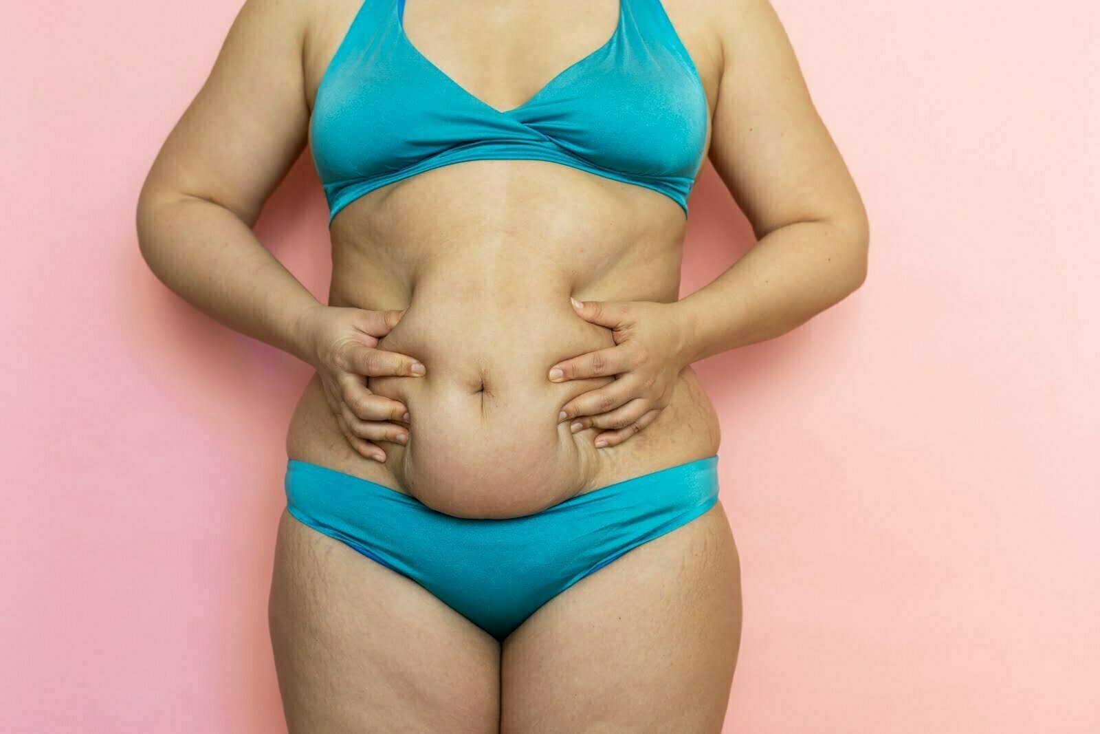 Signs of a Bad Tummy Tuck: Tummy Tuck Gone Wrong - Salameh Plastic