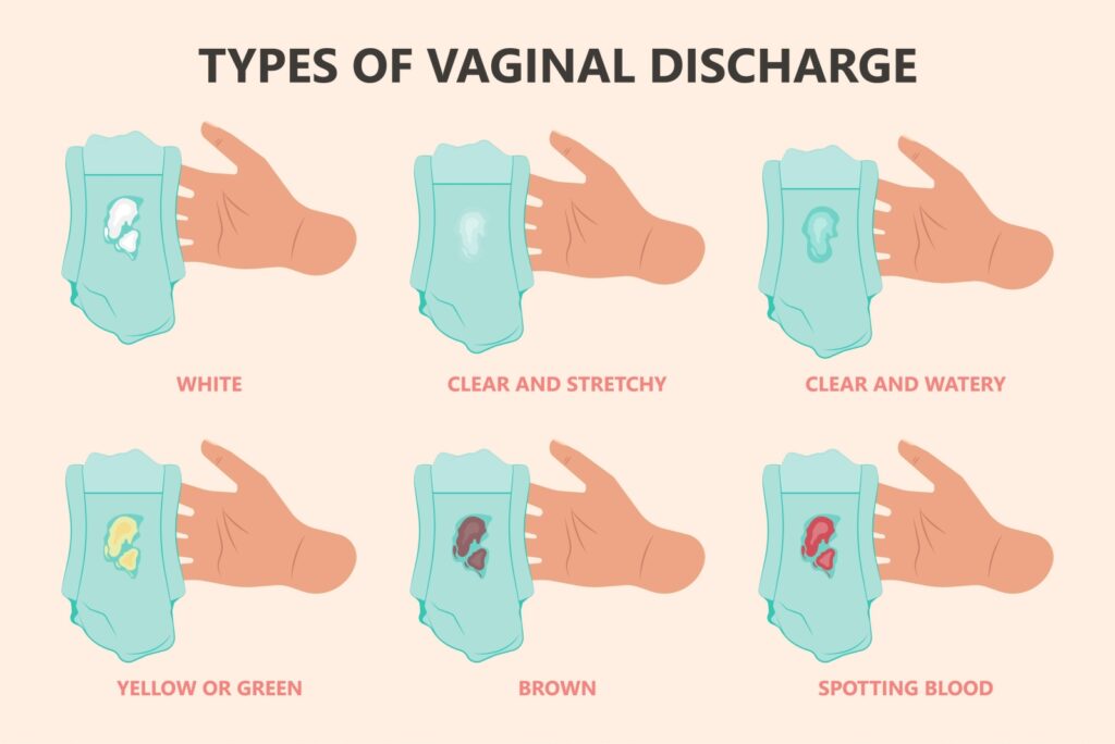 All Different Vulva Types are Completely Normal - Poosh