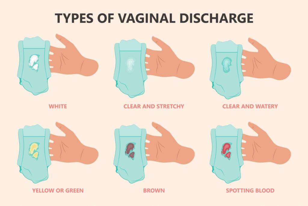 discharge-during-pregnancy-color-and-consistency-causes