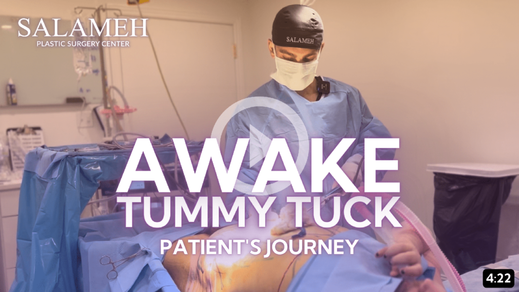 Tummy Tuck - Salameh Plastic Surgery Center