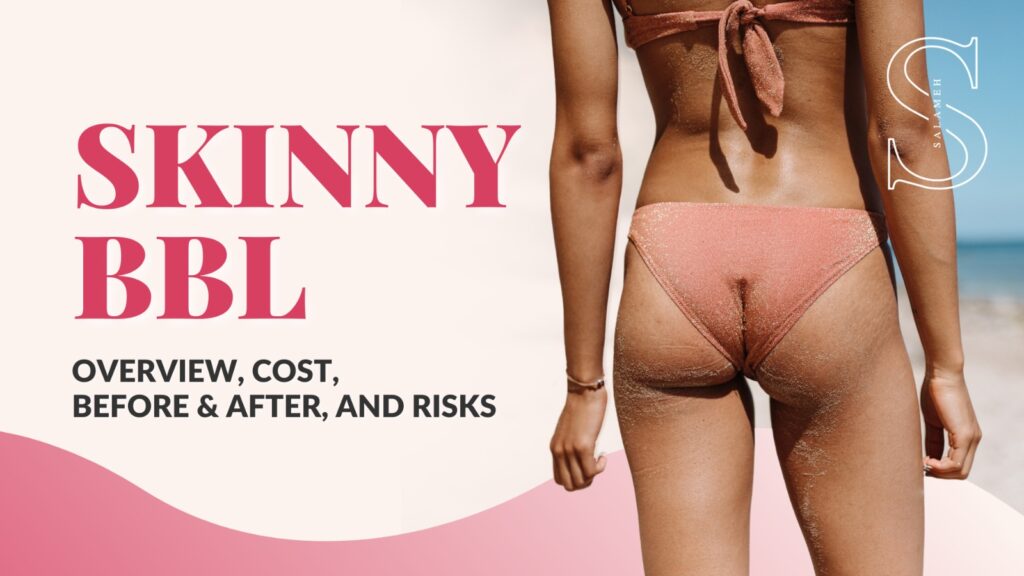 Skinny BBL overview, costs, before & after and risks. A woman in a pink undies who had skinny bbl procedure.