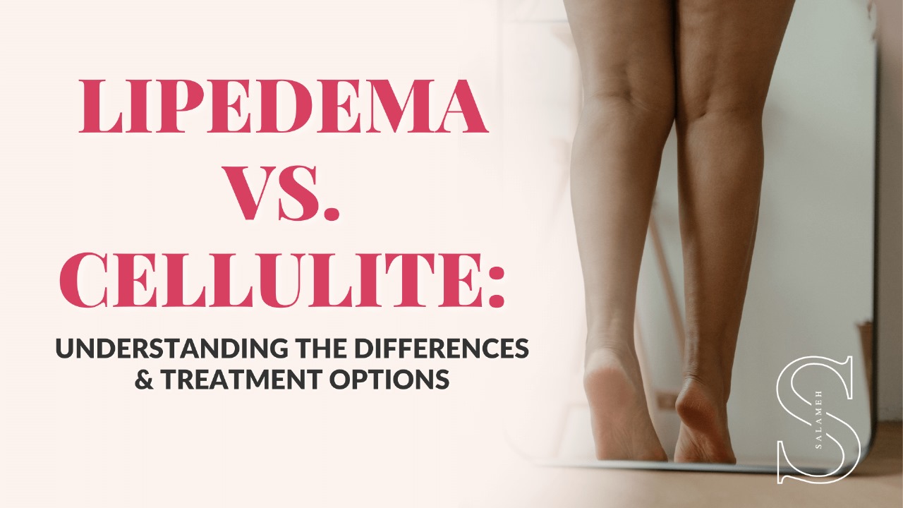 Cellulite vs fat vs lipedema: is it all just fat