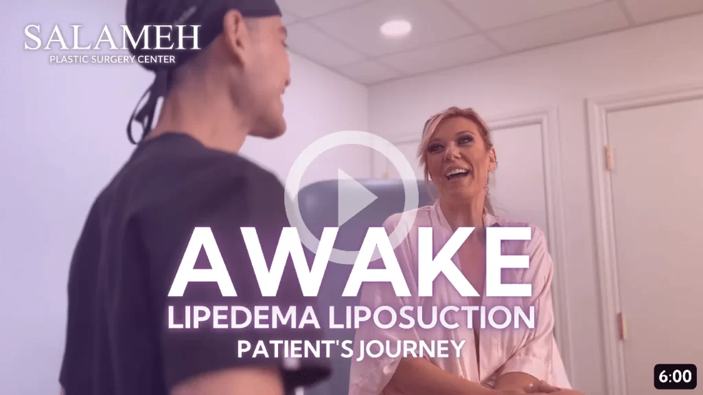 1 Awake Lipedema Treatment Located in Kentucky, USA