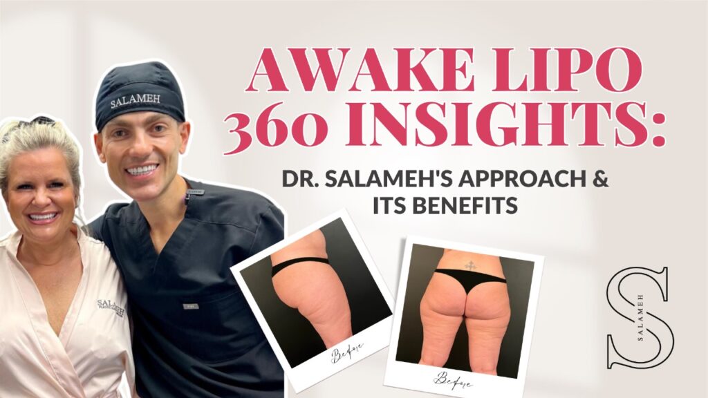 Awake Lipo 360 Insights: Dr. Salameh's Approach & Benefits