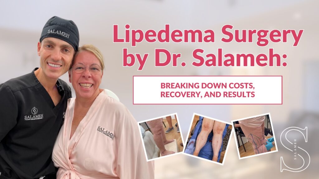 Lipedema Surgery: Breaking Down Costs, Recovery, & Results