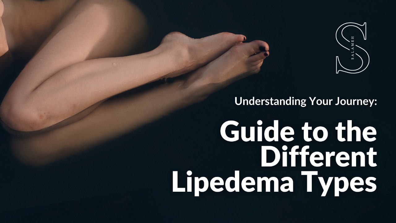 Understanding the Types of Lipedema & LippyLipo Treatment