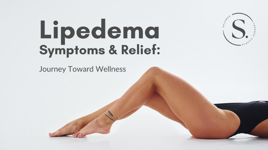 Lipedema : Symptoms, Treatment and Prevention - 2024
