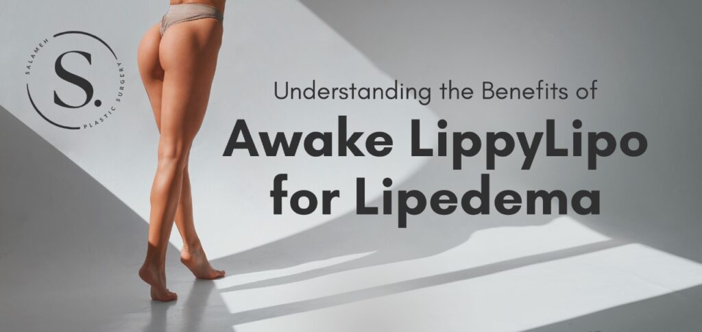 Understanding the Benefits of Awake LippyLipo for Lipedema