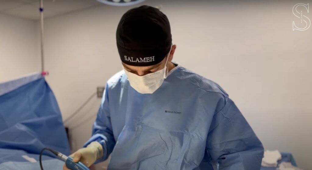 Dr. Salameh performing plastic surgery for lipedema, or LippyLipo procedure to his lipedema patient.