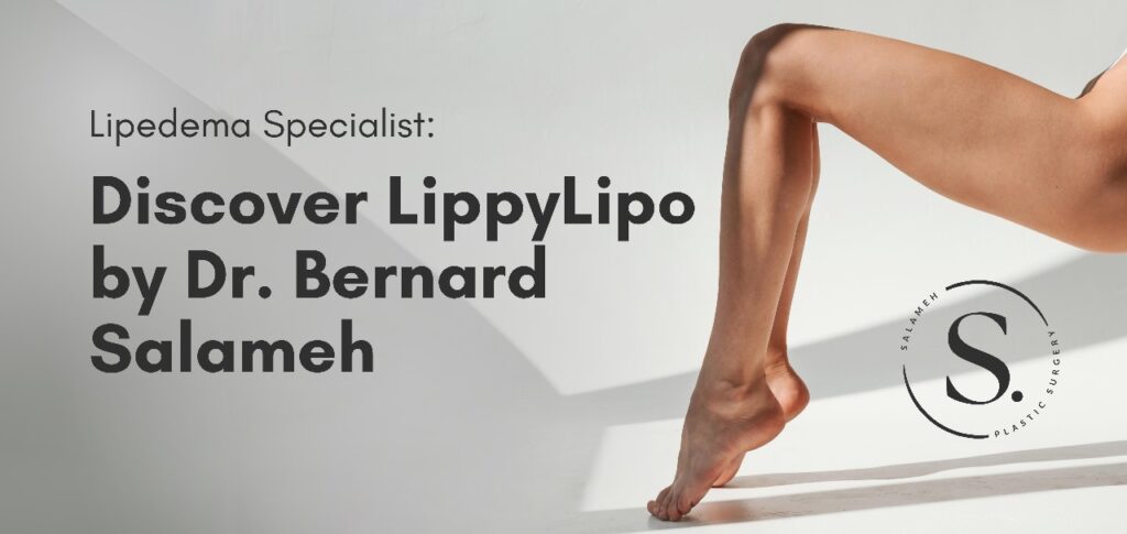 Lipedema Specialist: Discover LippyLipo by Dr. Salameh