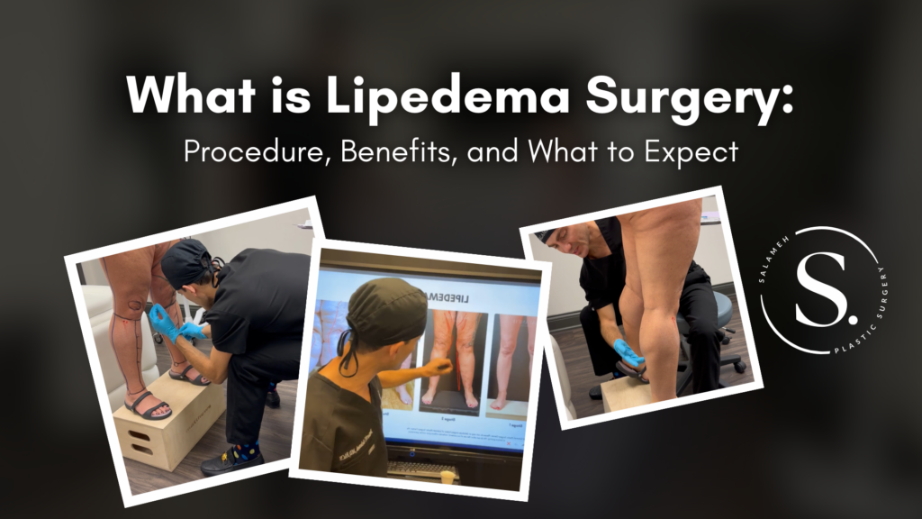 What is Lipedema Surgery: Procedure, Benefits, and What to Expect