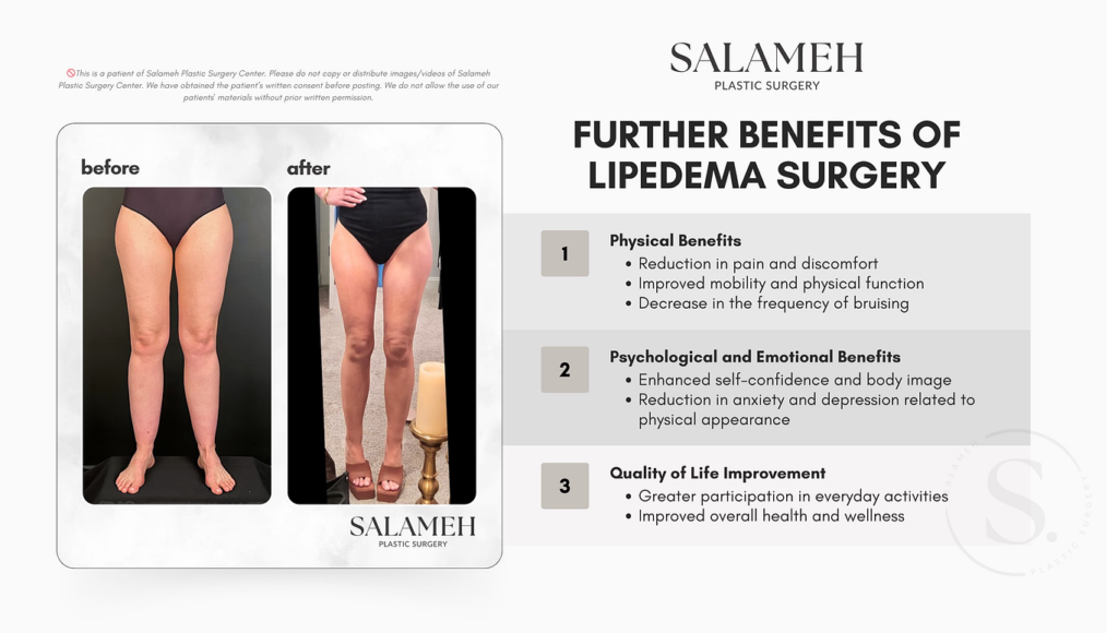 Illustration on the Benefits of Lipedema Surgery.