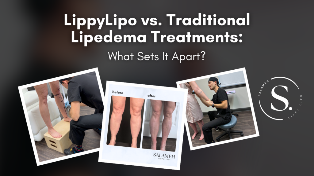 LippyLipo vs. Traditional Lipedema Treatments